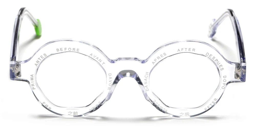 Sabine Be® Before X After - Image 7